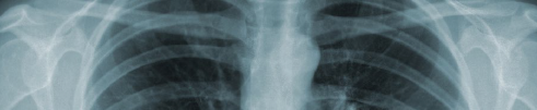 serious industrial conditions or diseases.fw