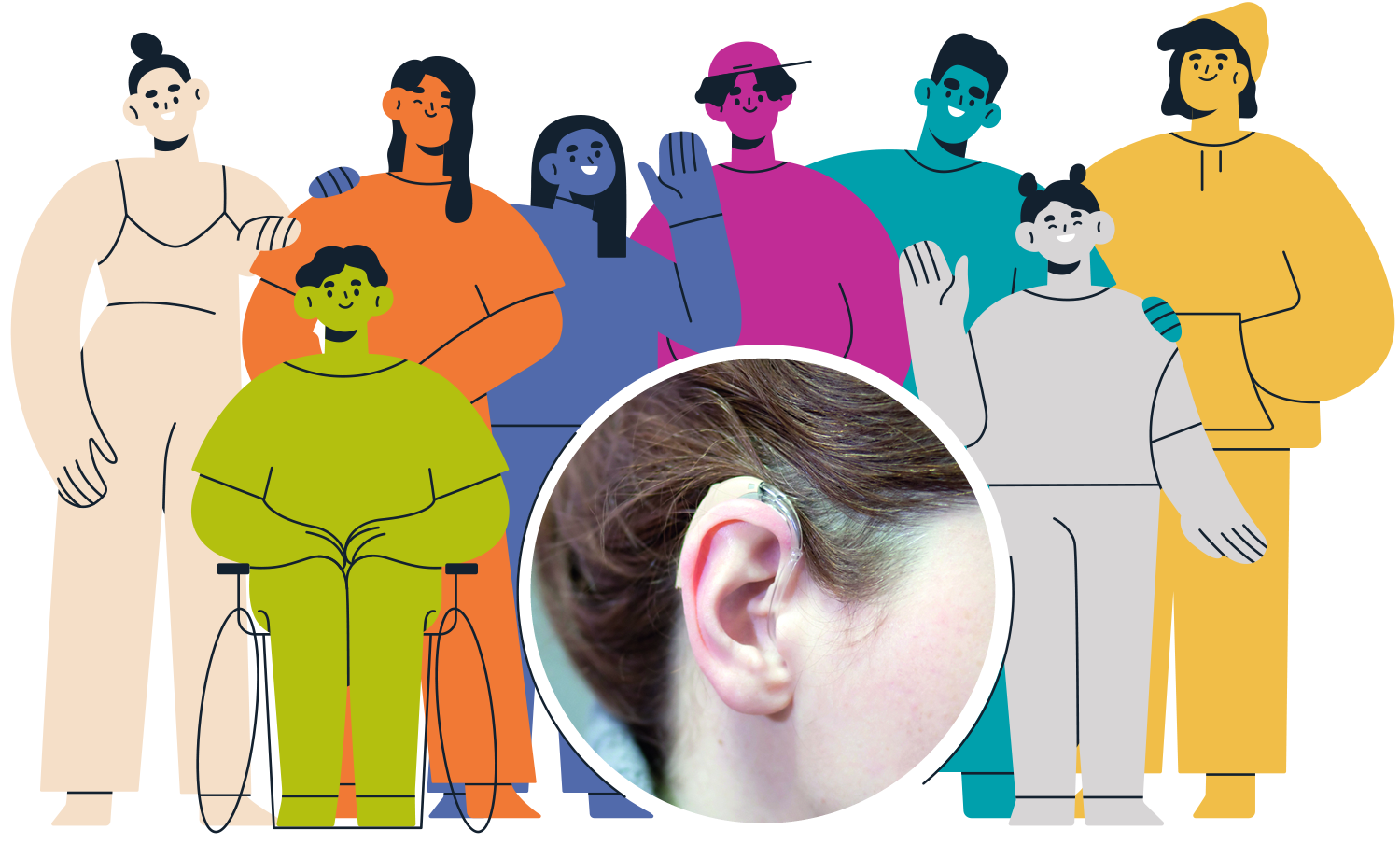 TOP HEARING LOSS 1